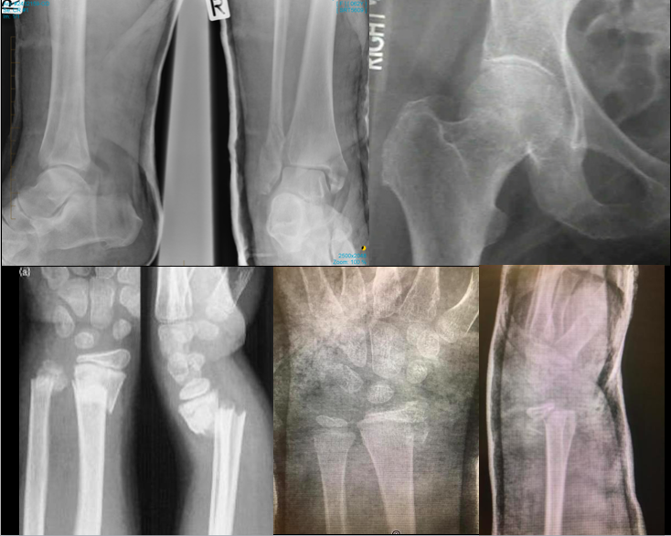 orthopaedic research case discussions - Orthohub