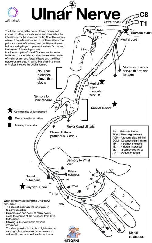 ulnar paradox